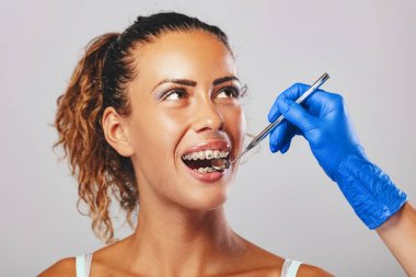 depositphotos_295199904-stock-photo-close-view-dentist-checking-braces